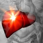 could fatty liver heal itself
