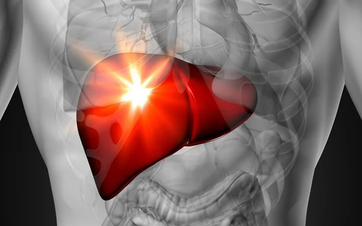 could fatty liver heal itself