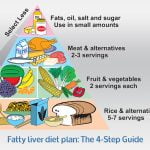 fatty liver diet plan