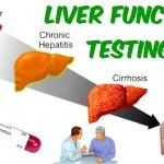 Liver Function Tests