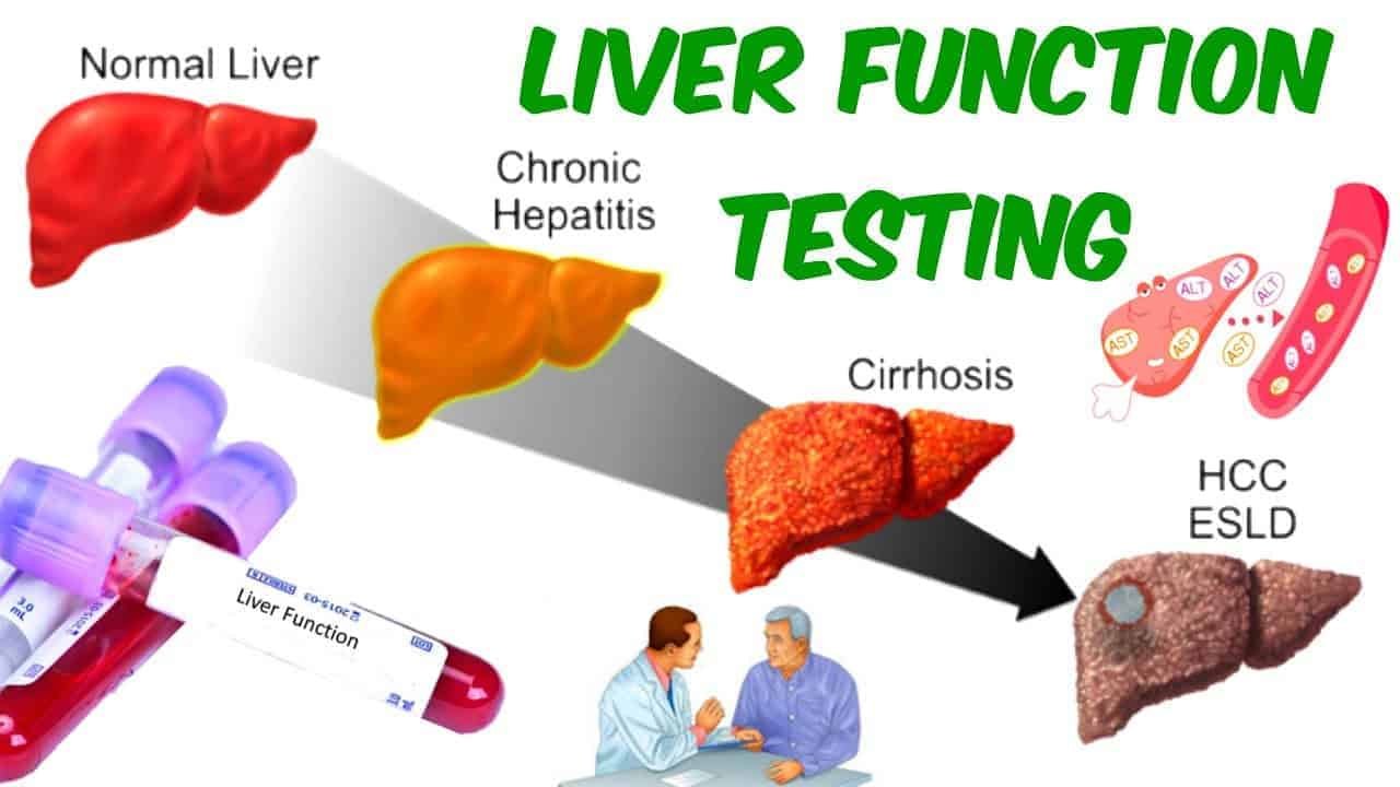 What Are Liver Function Tests Fatty Liver Guide 2711