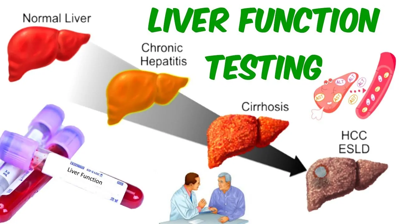 Liver Function Tests