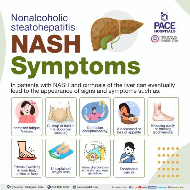 NASH symptoms