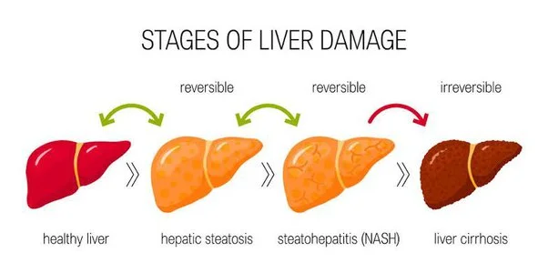 liver damages