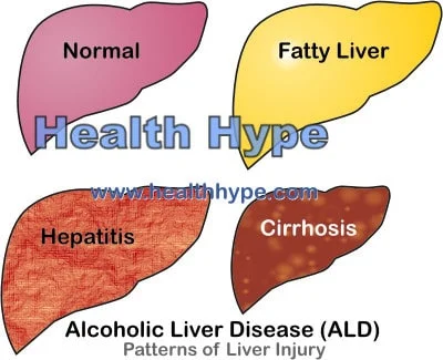  symptoms of congested liver