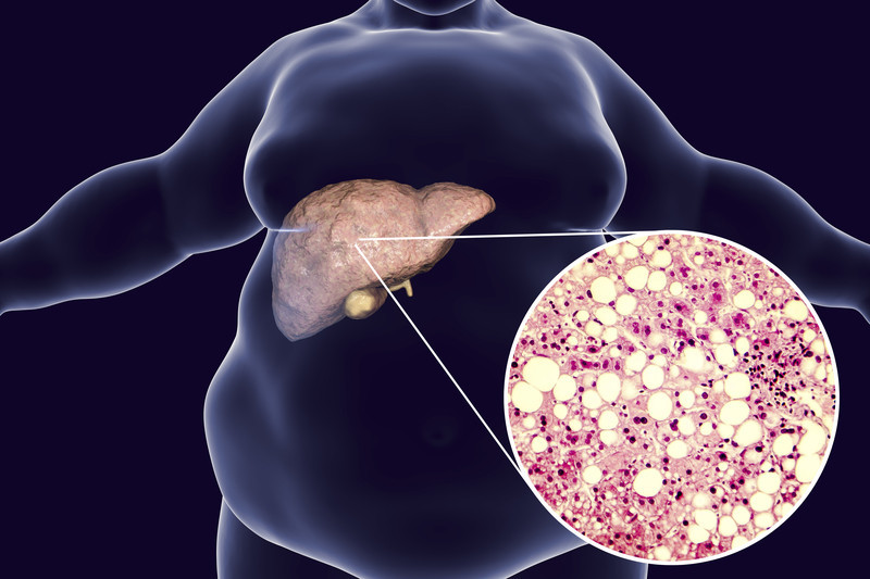 10 Warning Signs Your Liver Is Crying for Help