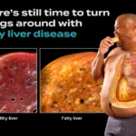 10 Warning Signs Your Liver Is Crying for Help