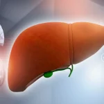 What Is MASLD Liver Disease