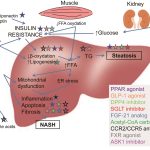 NASH F2 F3 Treatment