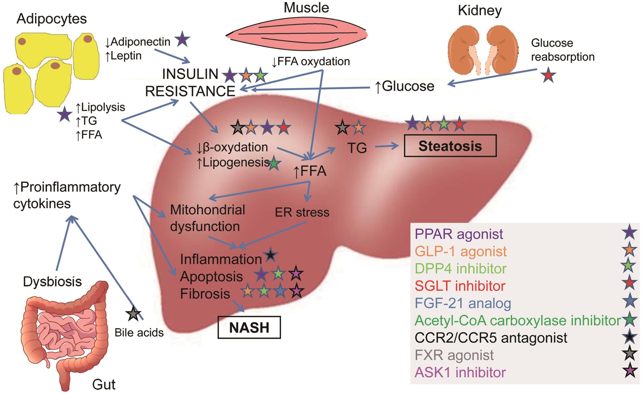 NASH F2 F3 Treatment: What Patients Should Know